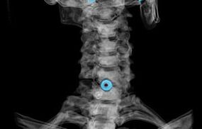 diagnostics