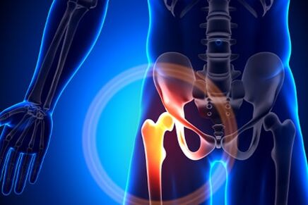 The pain in the hip joint