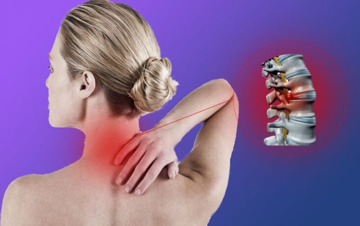 Inflammation of spine with cervical osteoohondrose