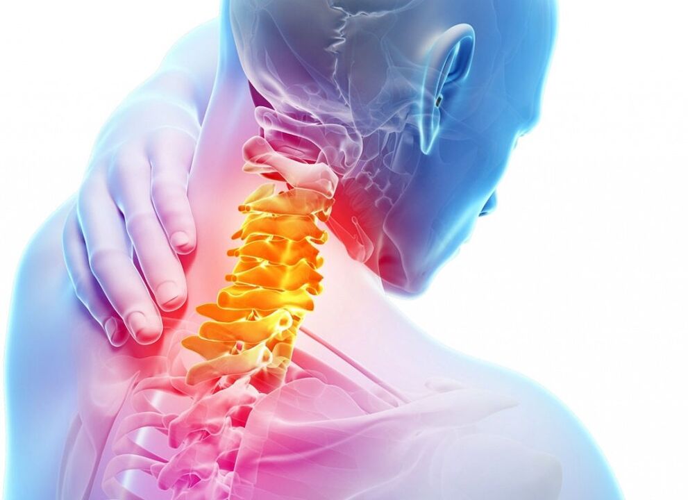 What is osteochondrosis of cervix