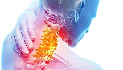 Cervical osteochondrose causes