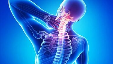 Complications of osteochondrize cervix